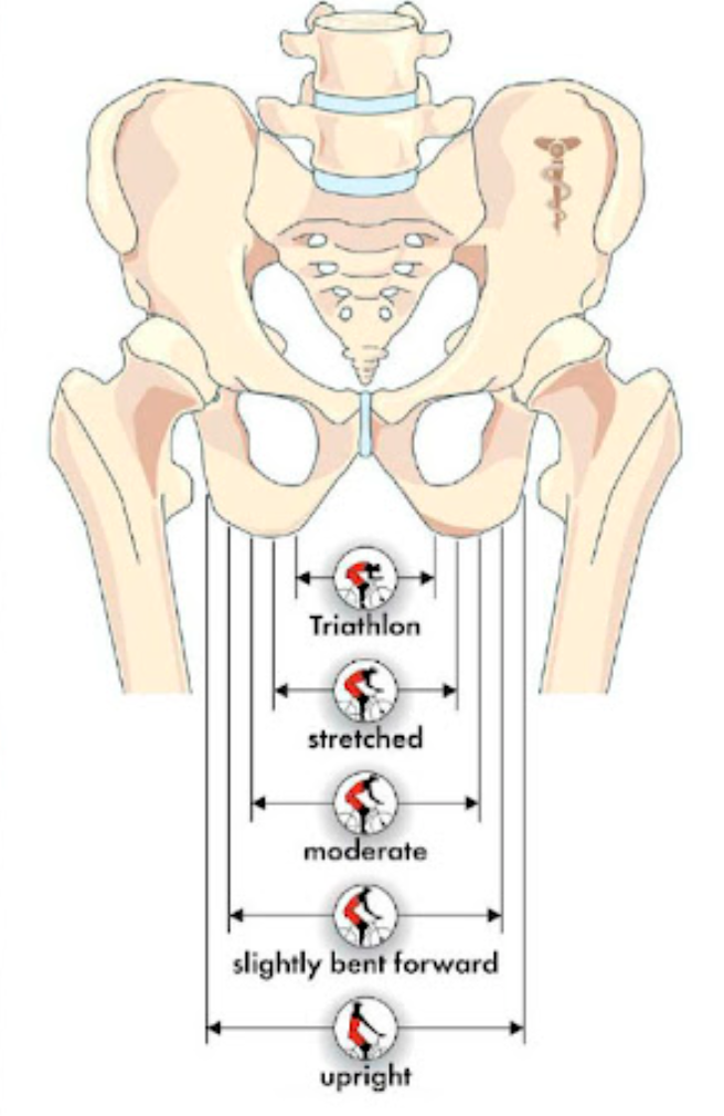 Ширина седалищных костей Ширина седалищных костей